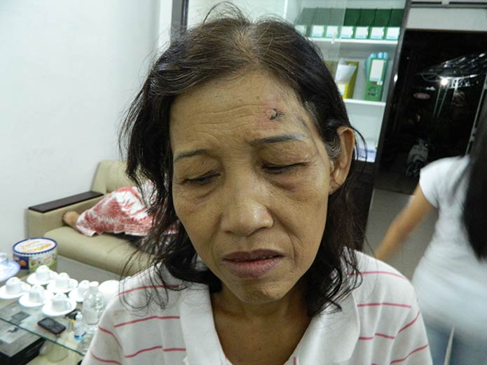 Saigon Nguyen Thi Cuc in hospital 060513