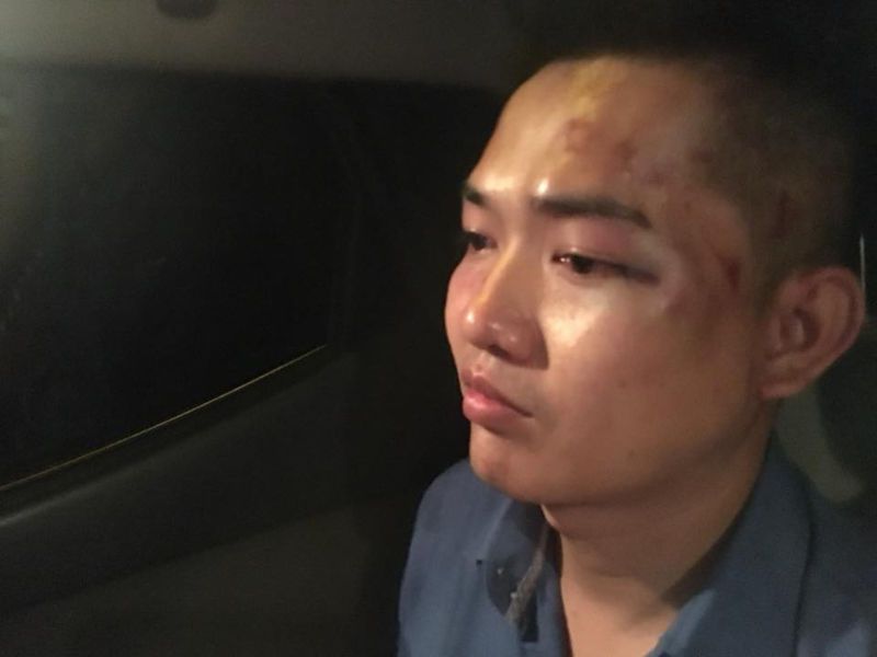 Nguyen Tin head injury Source FB Duong Dai Trieu Lam 180816