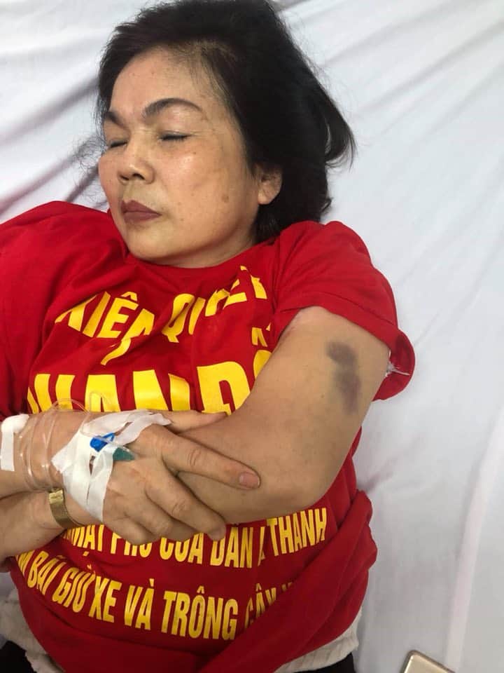 Injured protester 11.15.18_Facebook Ho Dan Day So Nha Le Duong De La Thanh